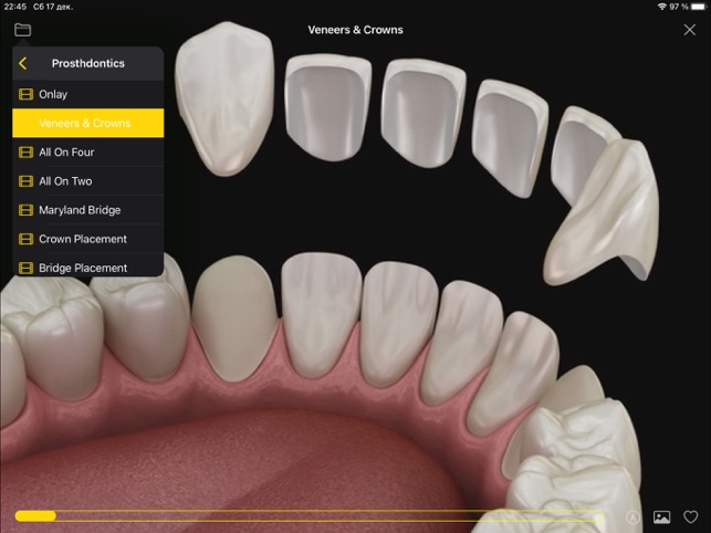 Dental Animations 1.1 ios官方版