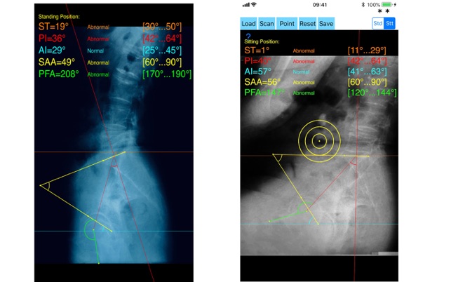 SpinopelvicMobilityApp ios官方版