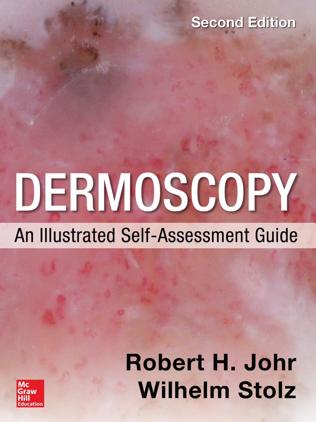 Dermoscopy Self 1.5 ios官方版